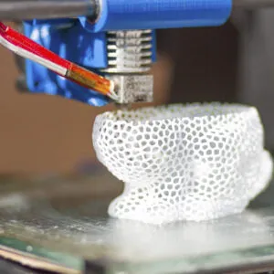 Escáner CAD/CAM y fabricación de plantillas a medida en Ortopedia Fresneda